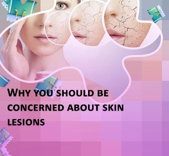 Very dry skin on face